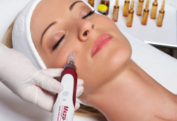 MezoPen® (mezoterapia mikroigłowa) -  to nowoczesne urządzenie dające wspaniałe efekty leczenia niedoskonałości skóry. Jest to mikroigłowe urządzenie frakcyjne z unikatową wymienną końcówką wyposażoną w jednorazowe igły. 